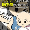 ワクチン打ってから脱毛症になりました～おハゲ記録～